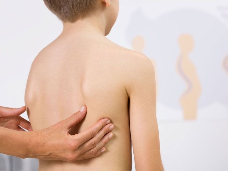Adolescenti e postura: l’importanza di fare esercizio terapeutico, movimento e sport