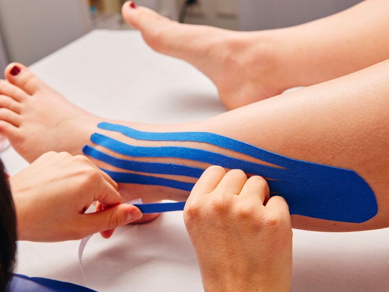 Il Kinesio Taping: quei misteriosi cerottoni colorati.